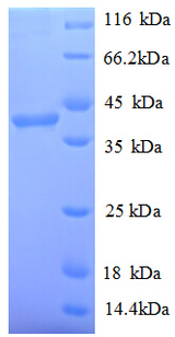 PARP11 Protein