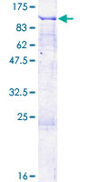 PARP13 / ZC3HAV1 Protein - 12.5% SDS-PAGE of human ZC3HAV1 stained with Coomassie Blue