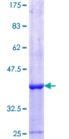 PARP13 / ZC3HAV1 Protein - 12.5% SDS-PAGE Stained with Coomassie Blue
