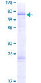 PARP15 Protein - 12.5% SDS-PAGE of human PARP15 stained with Coomassie Blue