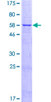 PARP16 Protein - 12.5% SDS-PAGE of human PARP16 stained with Coomassie Blue