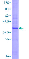PARP2 Protein - 12.5% SDS-PAGE Stained with Coomassie Blue.