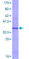 PARP2 Protein - 12.5% SDS-PAGE Stained with Coomassie Blue.