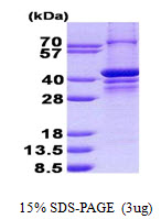 PARP2 Protein