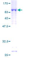PARP3 Protein - 12.5% SDS-PAGE of human PARP3 stained with Coomassie Blue