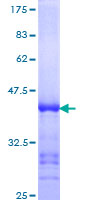 PARP4 / VPARP Protein - 12.5% SDS-PAGE Stained with Coomassie Blue.