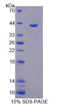 PARP4 / VPARP Protein - Recombinant  Poly ADP Ribose Polymerase 4 By SDS-PAGE