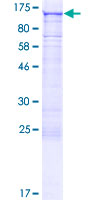 PARP8 Protein - 12.5% SDS-PAGE of human PARP8 stained with Coomassie Blue