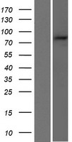 PARP9 Protein - Western validation with an anti-DDK antibody * L: Control HEK293 lysate R: Over-expression lysate