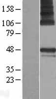 PARS2 Protein - Western validation with an anti-DDK antibody * L: Control HEK293 lysate R: Over-expression lysate
