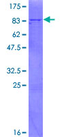 PARS2 Protein - 12.5% SDS-PAGE of human PARS2 stained with Coomassie Blue