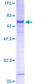 PARVB Protein - 12.5% SDS-PAGE of human PARVB stained with Coomassie Blue