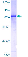 PARVG Protein - 12.5% SDS-PAGE of human PARVG stained with Coomassie Blue