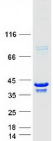 PARVG Protein - Purified recombinant protein PARVG was analyzed by SDS-PAGE gel and Coomassie Blue Staining