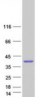 PARVG Protein - Purified recombinant protein PARVG was analyzed by SDS-PAGE gel and Coomassie Blue Staining