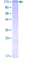 PASD1 Protein - 12.5% SDS-PAGE of human PASD1 stained with Coomassie Blue