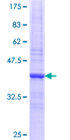 PASD1 Protein - 12.5% SDS-PAGE Stained with Coomassie Blue.