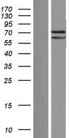 PATL2 Protein - Western validation with an anti-DDK antibody * L: Control HEK293 lysate R: Over-expression lysate