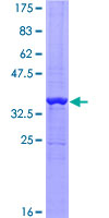 PATZ1 / PATZ Protein - 12.5% SDS-PAGE Stained with Coomassie Blue.