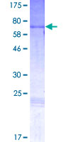 PAX2 Protein - 12.5% SDS-PAGE of human PAX2 stained with Coomassie Blue