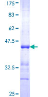 PAX2 Protein - 12.5% SDS-PAGE Stained with Coomassie Blue.