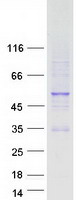 PAX2 Protein - Purified recombinant protein PAX2 was analyzed by SDS-PAGE gel and Coomassie Blue Staining