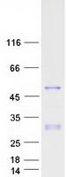 PAX2 Protein - Purified recombinant protein PAX2 was analyzed by SDS-PAGE gel and Coomassie Blue Staining