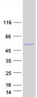 PAX2 Protein - Purified recombinant protein PAX2 was analyzed by SDS-PAGE gel and Coomassie Blue Staining