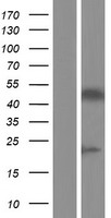 PAX3 Protein - Western validation with an anti-DDK antibody * L: Control HEK293 lysate R: Over-expression lysate