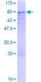 PAX3 Protein - 12.5% SDS-PAGE of human PAX3 stained with Coomassie Blue