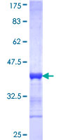 PAX4 Protein - 12.5% SDS-PAGE Stained with Coomassie Blue.