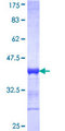 PAX4 Protein - 12.5% SDS-PAGE Stained with Coomassie Blue.