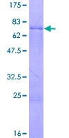 PAX5 Protein - 12.5% SDS-PAGE of human PAX5 stained with Coomassie Blue