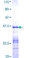 PAX5 Protein - 12.5% SDS-PAGE Stained with Coomassie Blue.