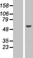 PAX6 Protein - Western validation with an anti-DDK antibody * L: Control HEK293 lysate R: Over-expression lysate