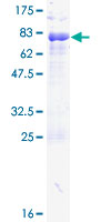 PAX6 Protein - 12.5% SDS-PAGE of human PAX6 stained with Coomassie Blue