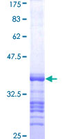 PAX6 Protein - 12.5% SDS-PAGE Stained with Coomassie Blue.