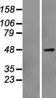 PAX7 Protein - Western validation with an anti-DDK antibody * L: Control HEK293 lysate R: Over-expression lysate