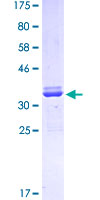 PAX7 Protein - 12.5% SDS-PAGE Stained with Coomassie Blue.
