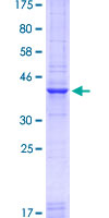PAX7 Protein - 12.5% SDS-PAGE Stained with Coomassie Blue.