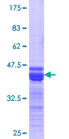 PAX8 Protein - 12.5% SDS-PAGE Stained with Coomassie Blue.