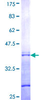PAX8 Protein - 12.5% SDS-PAGE Stained with Coomassie Blue.
