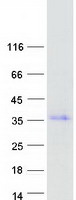 PAX8 Protein - Purified recombinant protein PAX8 was analyzed by SDS-PAGE gel and Coomassie Blue Staining