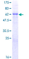 PAX9 Protein - 12.5% SDS-PAGE of human PAX9 stained with Coomassie Blue