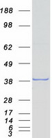 PAX9 Protein - Purified recombinant protein PAX9 was analyzed by SDS-PAGE gel and Coomassie Blue Staining
