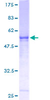 PBK / TOPK Protein - 12.5% SDS-PAGE of human PBK stained with Coomassie Blue