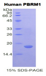 PBRM1 / BAF180 / PB1 Protein - Recombinant Polybromo 1 By SDS-PAGE