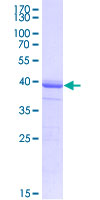 PBX1 Protein - 12.5% SDS-PAGE Stained with Coomassie Blue