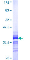 PBX2 Protein - 12.5% SDS-PAGE Stained with Coomassie Blue.