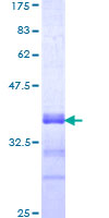PBX3 Protein - 12.5% SDS-PAGE Stained with Coomassie Blue.